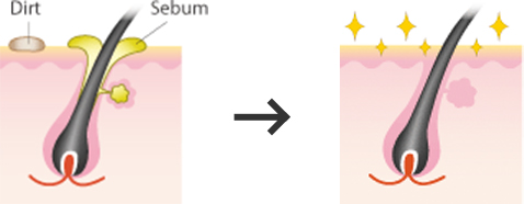 Clean right to the pores